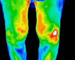 Full Body & Region of Interest Scans | Thermal Body Scan