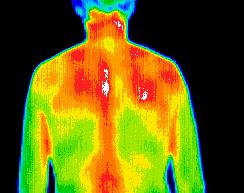 Full Body & Region of Interest Scans | Thermal Body Scan